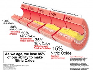 How_Arteries_Age